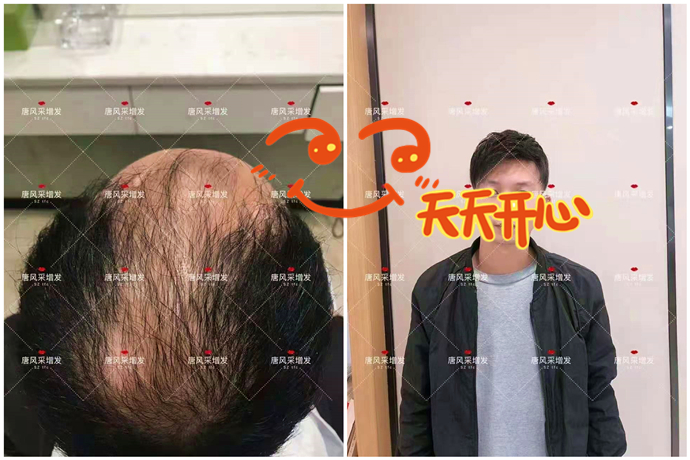 真發(fā)假發(fā)品牌哪家好 \