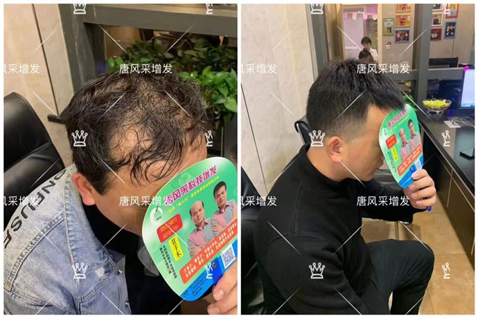 真發(fā)假發(fā)品牌哪家好 \