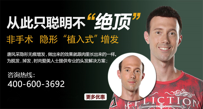 頭頂補(bǔ)發(fā)片買哪種好 \