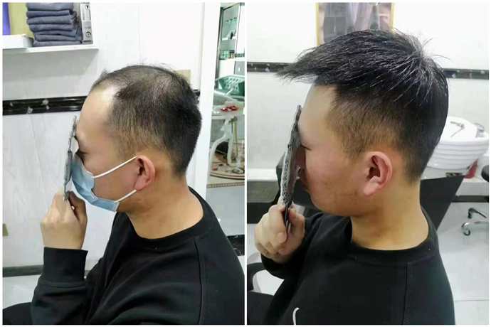 戴假發(fā)會很麻煩嗎 \
