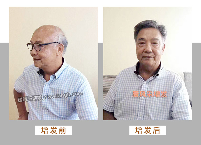 一輩子戴假發(fā) \