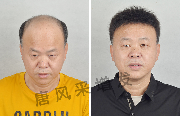 真人假發(fā)品牌哪個(gè)好 \