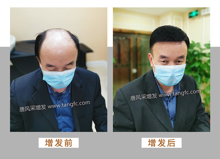 真人假發(fā)品牌哪個(gè)好 \