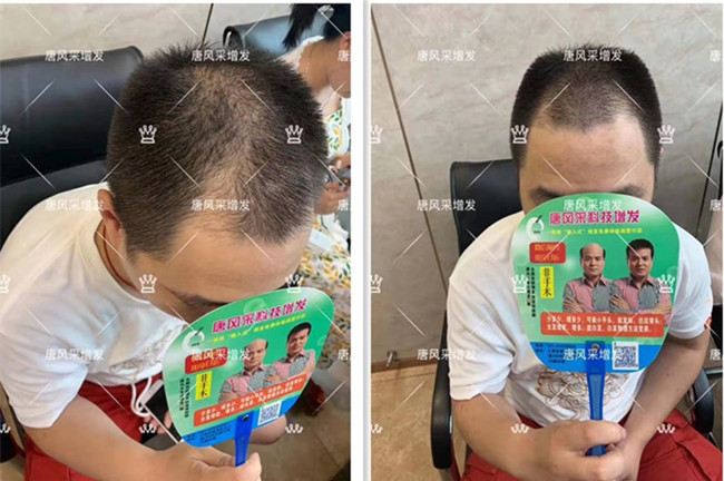 真人假發(fā)品牌哪個(gè)好 \