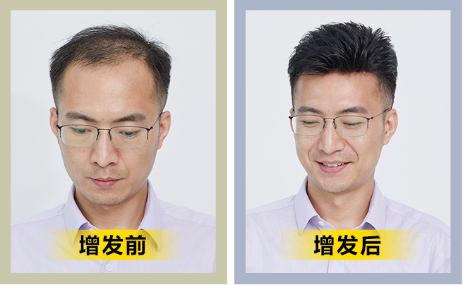 逼真男性假發(fā)片 \