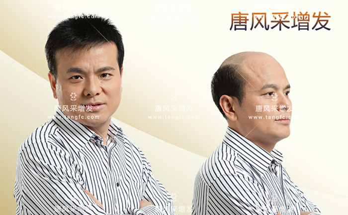男士夏天戴假發(fā) \