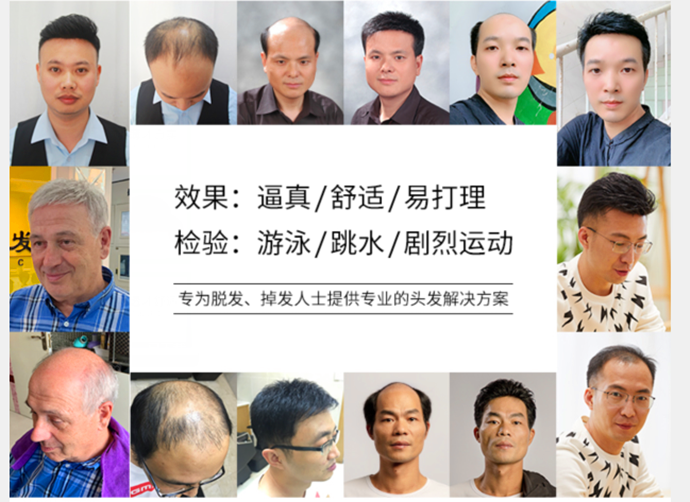 男士假發(fā)發(fā)塊 \