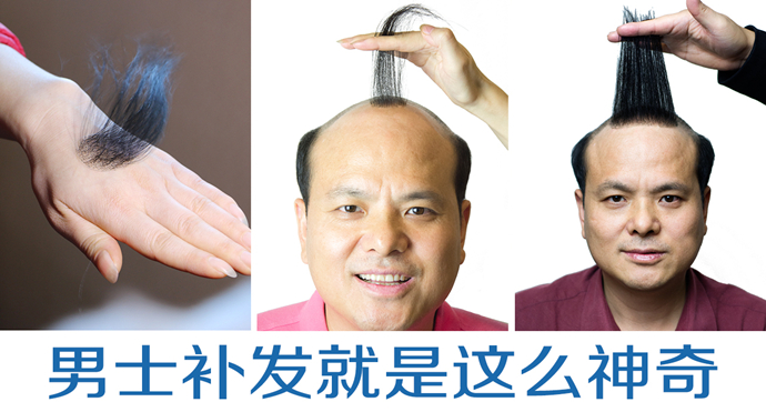 以發(fā)補發(fā) \