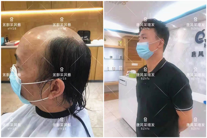 以發(fā)補發(fā) \