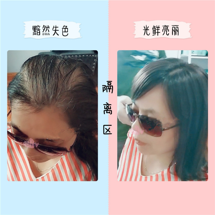 禿頂戴假發(fā)方便嗎 \