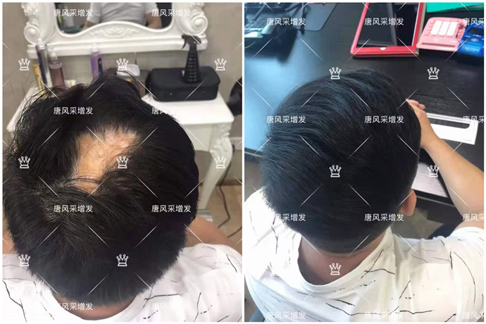 真發(fā)假發(fā)專賣店推薦 \