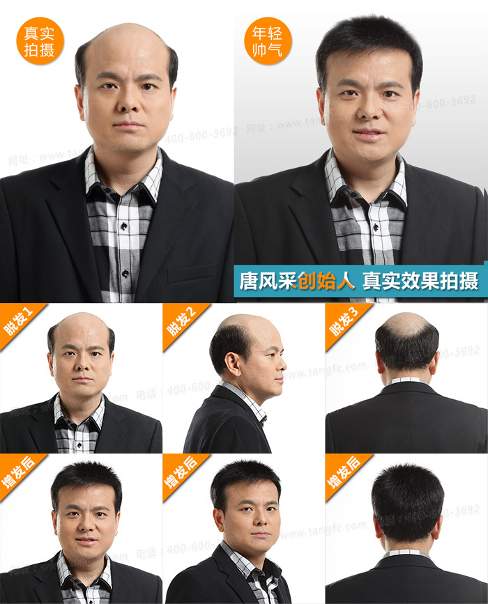 假發(fā)私人定制實(shí)體店 \