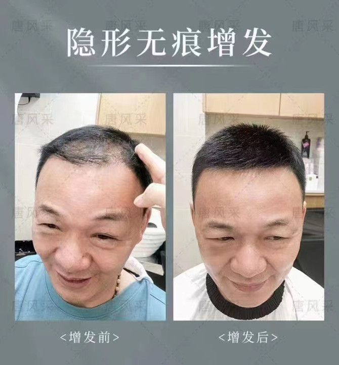 假發(fā)私人定制實(shí)體店 \