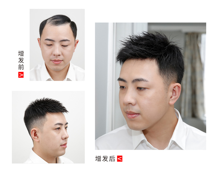 品牌男士假發(fā) \