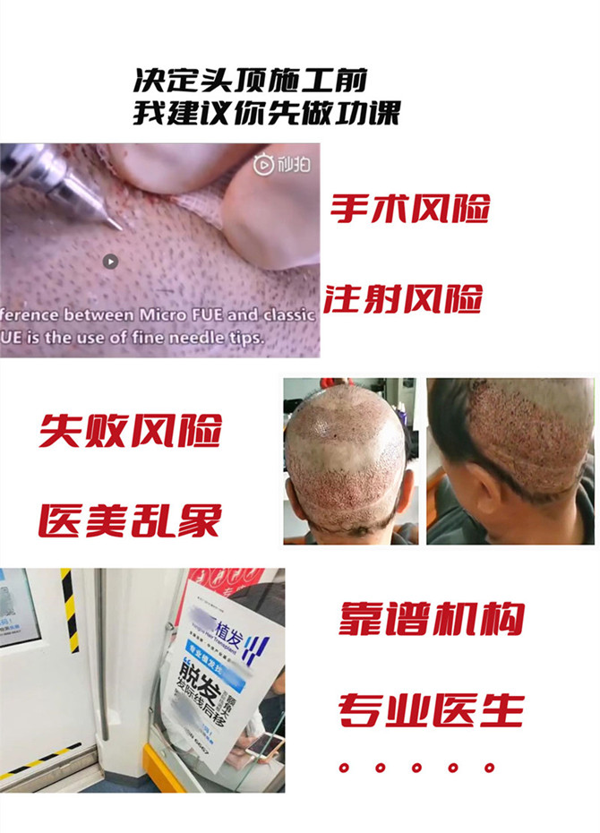 品牌男士假發(fā) \