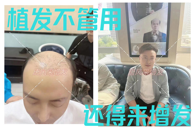 品牌男士假發(fā) \