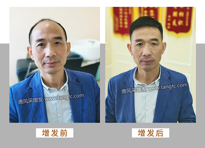 男人戴假發(fā)能看出來嗎 \