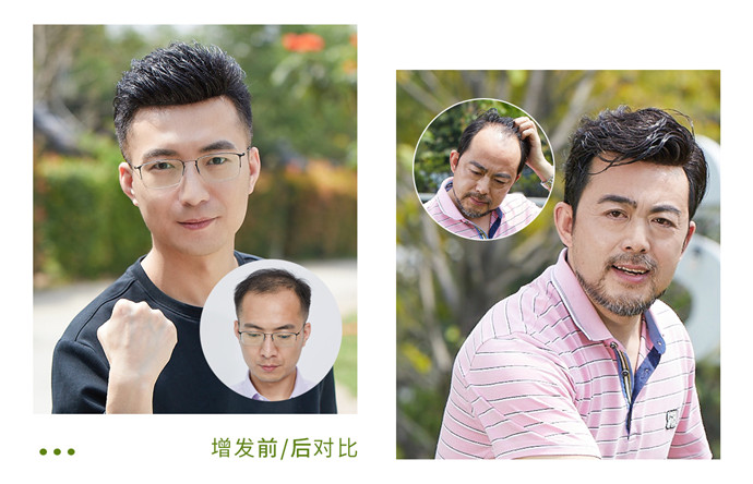 男人戴假發(fā)能看出來嗎 \
