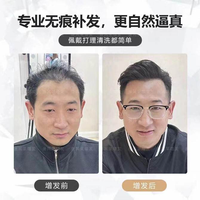 假發(fā)塊粘貼佩戴技巧 \