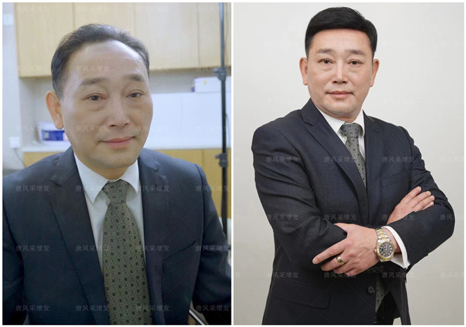 假發(fā)塊粘貼佩戴技巧 \